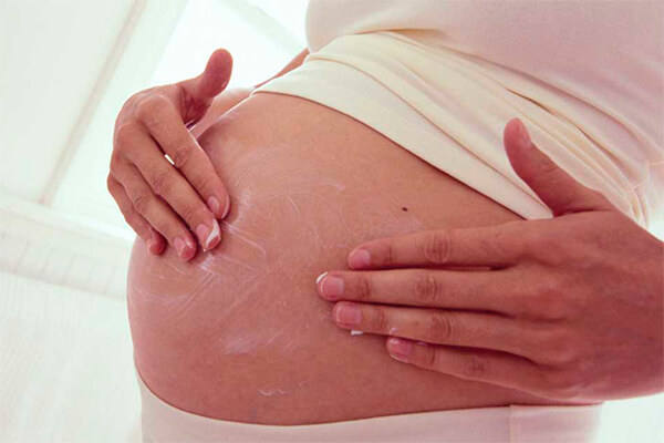 ¿Cómo prevenir las estrías durante el embarazo?