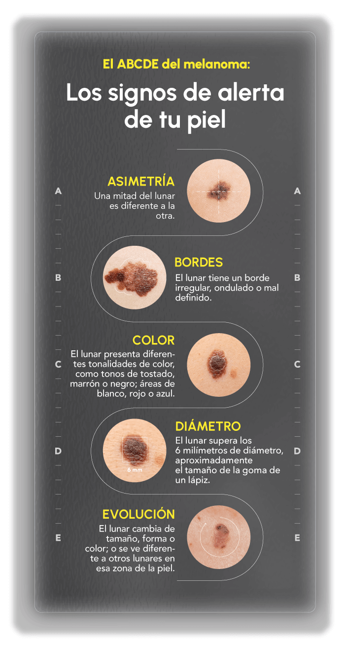 Claves A-B-C-D-E